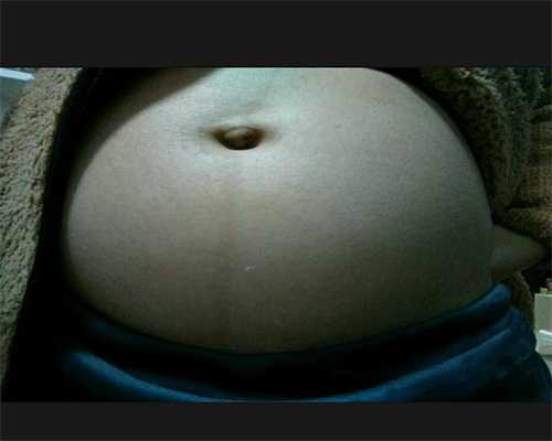 供卵排队等多久，多囊卵巢可以代孕_女性须警惕